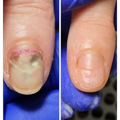 Podolog Białystok Dama Pik Izabela Fraind